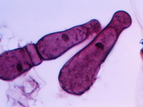parasitic protozoa