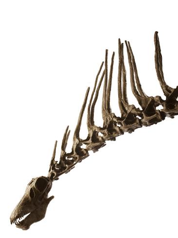 Spine Cast
