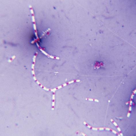 endospore stain