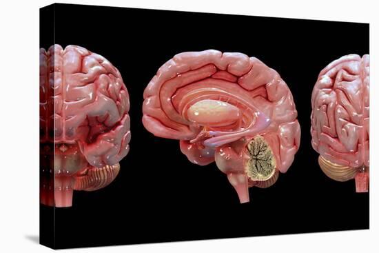 3D Rendering of Human Brain-Stocktrek Images-Stretched Canvas