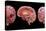 3D Rendering of Human Brain-Stocktrek Images-Stretched Canvas