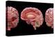 3D Rendering of Human Brain-Stocktrek Images-Stretched Canvas