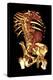 Abdominal Aortic Aneurysm, 3D CT Scan-Du Cane Medical-Premier Image Canvas