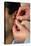 Acupuncturist's Hands Insert Needle Into Man's Ear-Damien Lovegrove-Premier Image Canvas