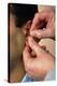 Acupuncturist's Hands Insert Needle Into Man's Ear-Damien Lovegrove-Premier Image Canvas