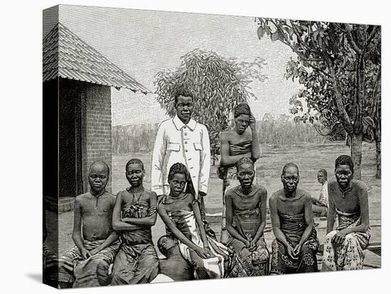 Africa. Native Affected by Sleeping Sickness, 1903-null-Premier Image Canvas