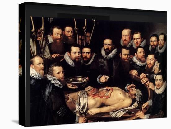 Anatomy Lesson Of Dr. Willem Van Der Meer-Sir Luke Fildes-Stretched Canvas