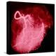 Arteriograph of the Coronary Arteries of the Heart-Science Photo Library-Premier Image Canvas