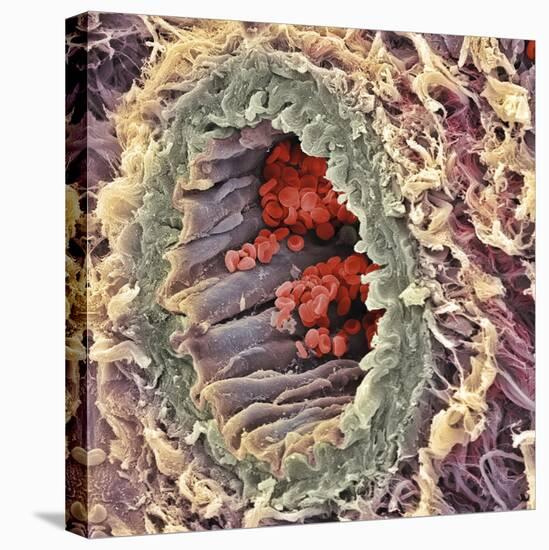 Artery SEM-Steve Gschmeissner-Premier Image Canvas