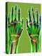 Arthritic Hands, X-ray-Du Cane Medical-Premier Image Canvas