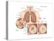 Asthma Attack-Encyclopaedia Britannica-Stretched Canvas