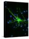Astrocyte Nerve Cell-Riccardo Cassiani-ingoni-Premier Image Canvas