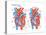 Atrial Septal Defect-Encyclopaedia Britannica-Stretched Canvas