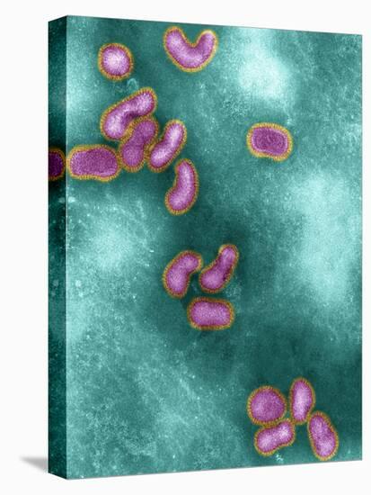 Avian Influenza Virus, TEM-NIBSC-Premier Image Canvas