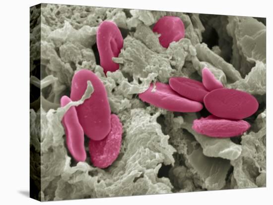 Bird Red Blood Cells, SEM-Steve Gschmeissner-Premier Image Canvas