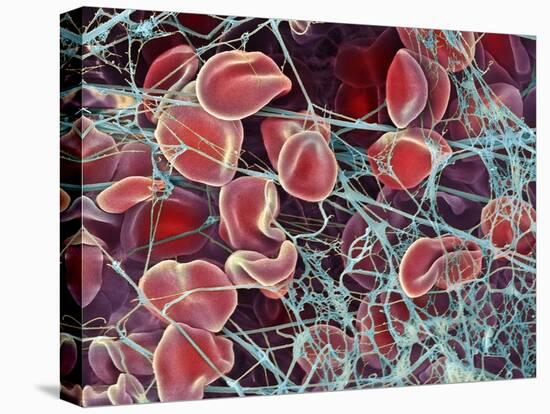 Blood Clot, SEM-Steve Gschmeissner-Premier Image Canvas