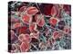 Blood Clot, SEM-Steve Gschmeissner-Premier Image Canvas