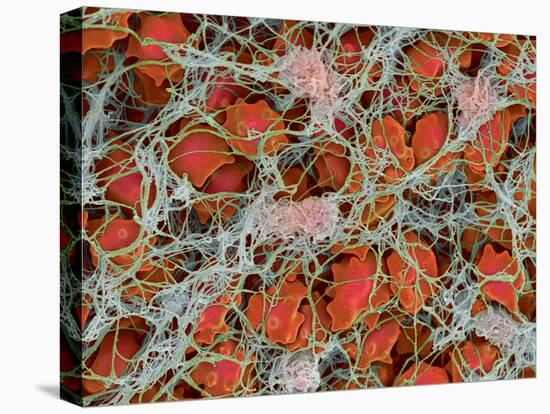 Blood Clot, SEM-Steve Gschmeissner-Premier Image Canvas