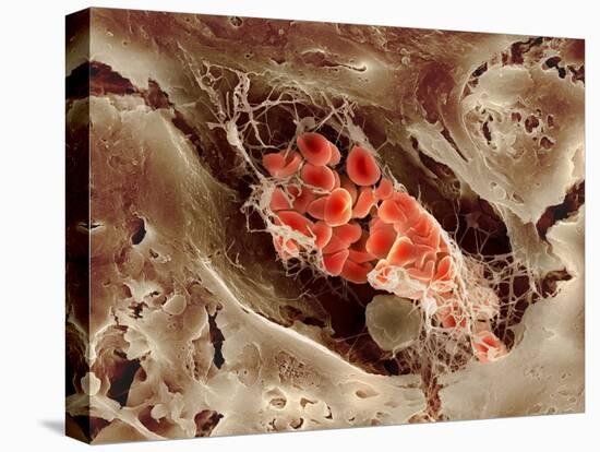 Blood Clot, SEM-Science Photo Library-Premier Image Canvas