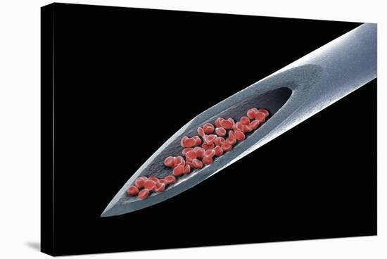 Blood on a Needle, SEM-Steve Gschmeissner-Premier Image Canvas