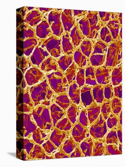 Blood Vessel Cast from Colon of a Rat-Micro Discovery-Premier Image Canvas