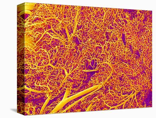 Blood Vessel Cast from Rat Pancreas-Micro Discovery-Premier Image Canvas