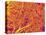 Blood Vessel Cast from Rat Pancreas-Micro Discovery-Premier Image Canvas