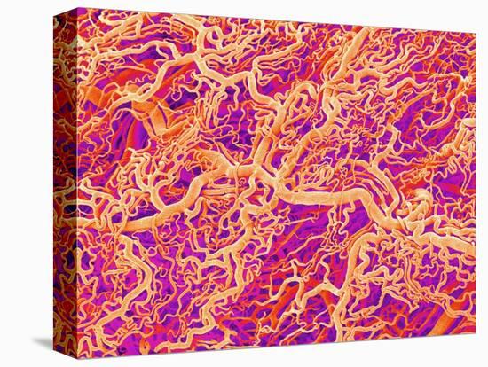 Blood Vessel Cast of Connective Tissue of a Rat-Micro Discovery-Premier Image Canvas