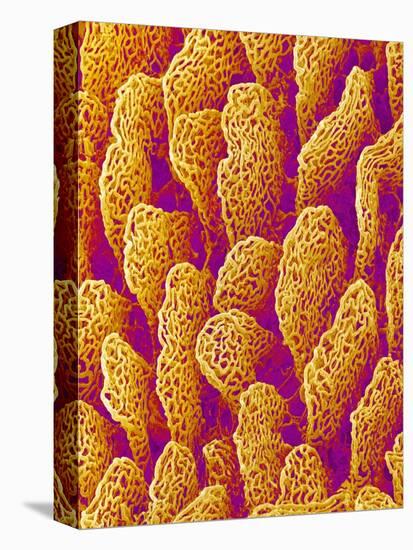 Blood Vessel Cast of the Duodenum of a Rat-Micro Discovery-Premier Image Canvas