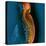 Bone Cancer, MRI-Du Cane Medical-Premier Image Canvas