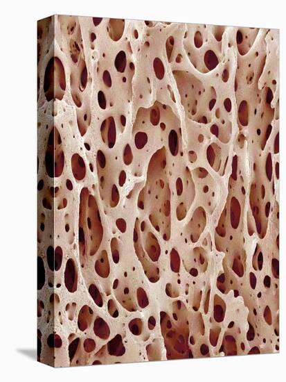 Bone Tissue-Micro Discovery-Premier Image Canvas