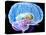 Brain Anatomy, Artwork-Roger Harris-Premier Image Canvas