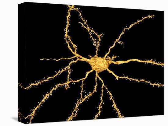 Brain Neuron-Thomas Deerinck-Premier Image Canvas
