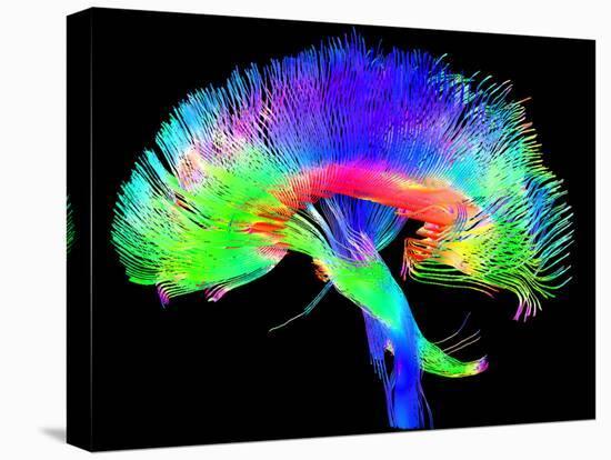Brain Pathways-Tom-Premier Image Canvas
