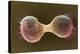 Breast Cancer Cells, SEM-Steve Gschmeissner-Premier Image Canvas