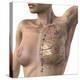 Breast Lymphatic System, Artwork-null-Premier Image Canvas