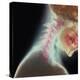 Broken Neck-Science Photo Library-Premier Image Canvas