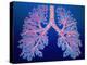 Bronchial Tree of Lungs-PASIEKA-Premier Image Canvas