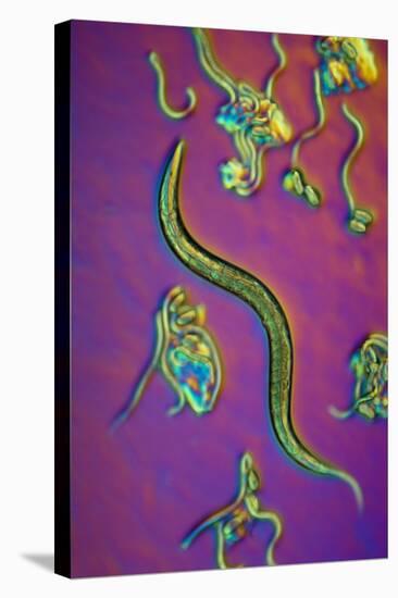 C. Elegans Worms, Light Micrograph-Sinclair Stammers-Premier Image Canvas