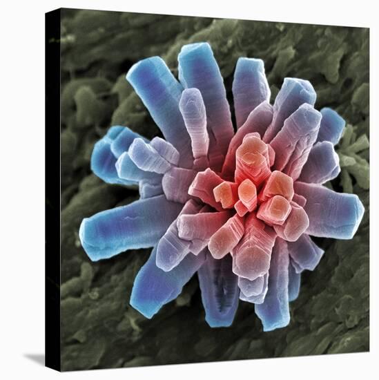 Calcium Phosphate Crystal, SEM-Steve Gschmeissner-Premier Image Canvas