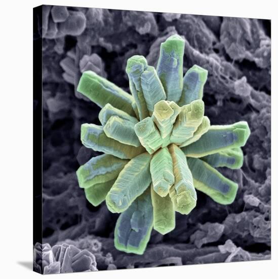 Calcium Phosphate Crystal, SEM-Steve Gschmeissner-Premier Image Canvas