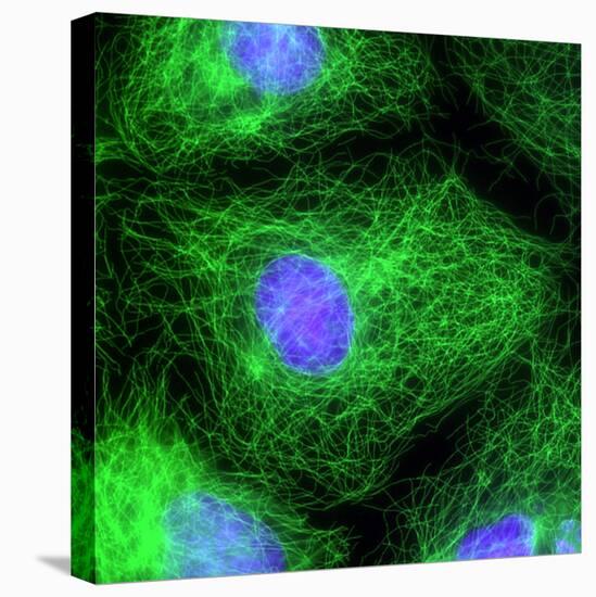 Cell Division, Fluorescent Micrograph-Dr. Torsten Wittmann-Premier Image Canvas