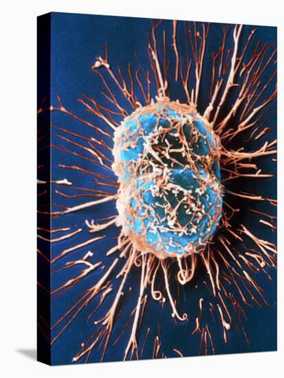 Cervical Cancer Cells Dividing-Steve Gschmeissner-Premier Image Canvas