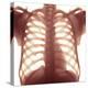 Chest X-ray of a Healhty Human Heart-Science Photo Library-Premier Image Canvas