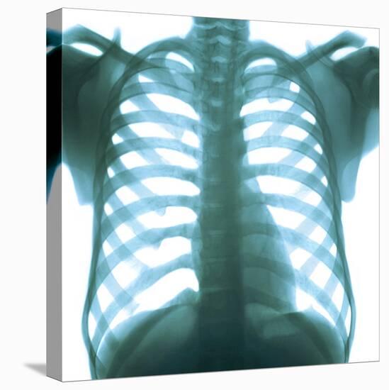 Chest X-ray of a Healthy Human Heart-Science Photo Library-Premier Image Canvas