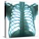 Chest X-ray of a Healthy Human Heart-Science Photo Library-Premier Image Canvas