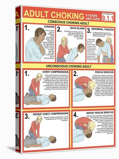 Choking First Aid Chart-Gwen Shockey-Premier Image Canvas