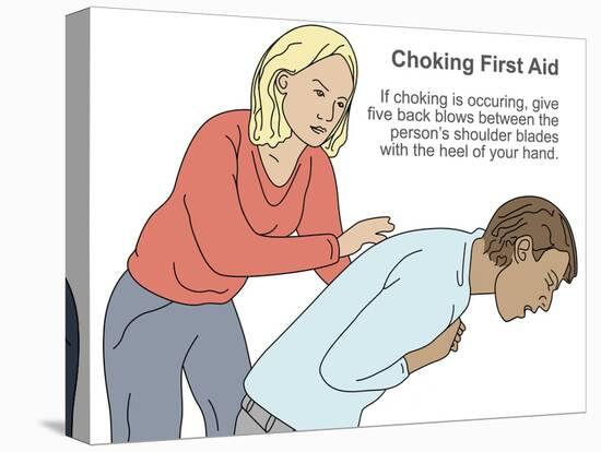 Choking First Aid-Gwen Shockey-Premier Image Canvas