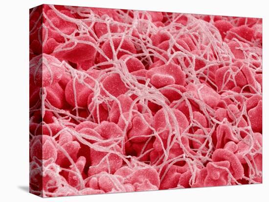 Coagulated Human Red Blood Cells-Micro Discovery-Premier Image Canvas