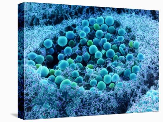 Col. SEM of Eye Melanocyte Cell & Pigment Granules-Steve Gschmeissner-Premier Image Canvas